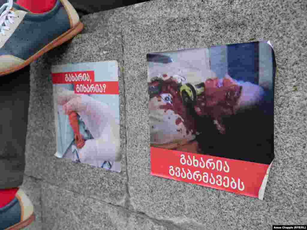 Плакати перед будівлею парламенту в Тбілісі. Протестувальники зазначають, що зображення праворуч показує демонстранта, якому ввечері 20 червня влучила в око гумова куля  