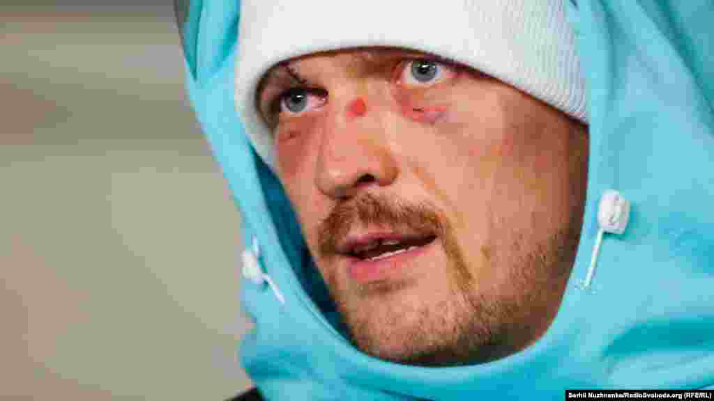 Боксер рассказал, что пояса WBA, WBO, IBF и IBO прибудут в Украину примерно через три недели, когда на них «выгравируют дату, место и имена». «Они уже скучают по Украине, они говорят: «Саня забери нас»», – Александр Усик