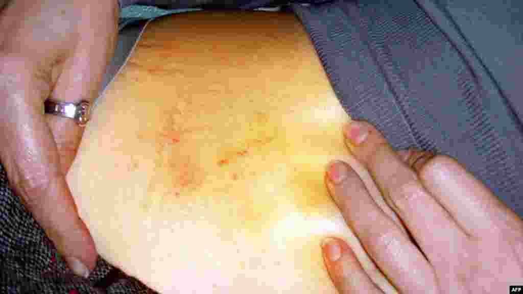 24 апреля стало известно, что с 20 апреля Юлия Тимошенко начала голодовку – после того, как ее избили в Качановской колонии и принудительно доставили на лечение в харьковскую больницу "Укрзализныци"