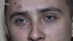 Били чимось схожим на биту – Стерненко про обставини свого побиття (відео) Били чимось схожим на биту – Стерненко про обставини свого побиття (відео)