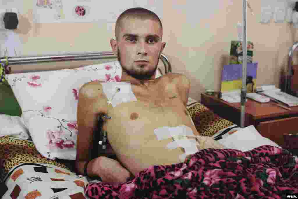 Конфеткін Максим. Поранення черевної порожнини, перитоніт, необхідна тривала реабілітація. Фото Олександра Чекменьова