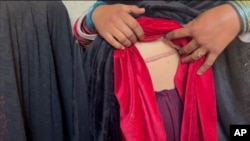 Unele femei afgane și-au vândut rinichii pentru a-și ajuta familiile să supraviețuiască crizelor umanitare și economice din timpul regimului taliban (fotografie de arhivă).