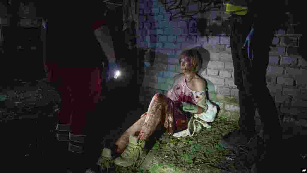 Раненая женщина у стены дома в Киеве