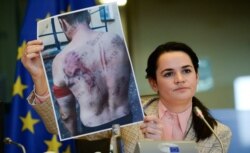 Білоруська опозиціонерка Світлана Тихановська демонструє фотографії зі слідами катувань. Брюссель, 21 вересня 2020 року
