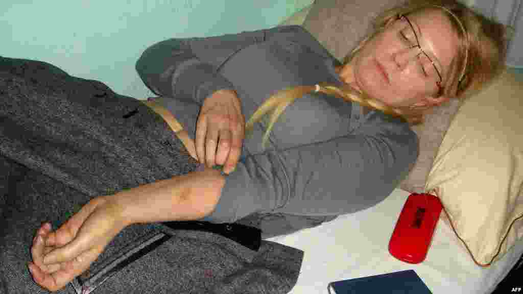  Наличие синяков на теле Тимошенко подтвердила посетившая ее Уполномоченная по правам человека Нина Карпачева, которая заявила, что такое конвоирование заключенной может быть расценено как применение к ней пыток.