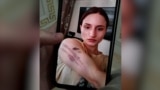 Фотография погибшей в Армении уроженки Чечни Айшат Баймурадовой со следами домашнего насилия