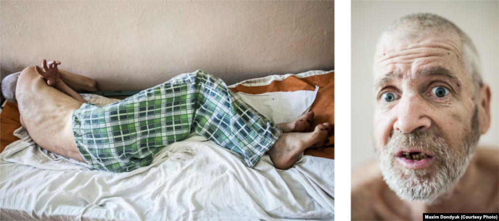 Олександр, 54 роки. Новотроїцький протитуберкульозний диспансер, липень 2011 року. Розповідь лікарів: «Був жорстоко побитий, втратив пам’ять. Ми не змогли знайти родичів. Багато галасує, поводиться агресивно. Коли закінчить курс лікування, його направлять до психлікарні». Розповідь хворого: «Мене звати Олександр Бухарьов. Я народився 1957 року і зараз живу в Херсоні. Я одружений, маю двох дітей. Туберкульоз залікували, тепер направляють до психіатричної лікарні для встановлення діагнозу».