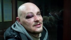 «Беркутівець» зірвав каску з написом «преса» і почав бити по голові – журналіст Радіо Свобода