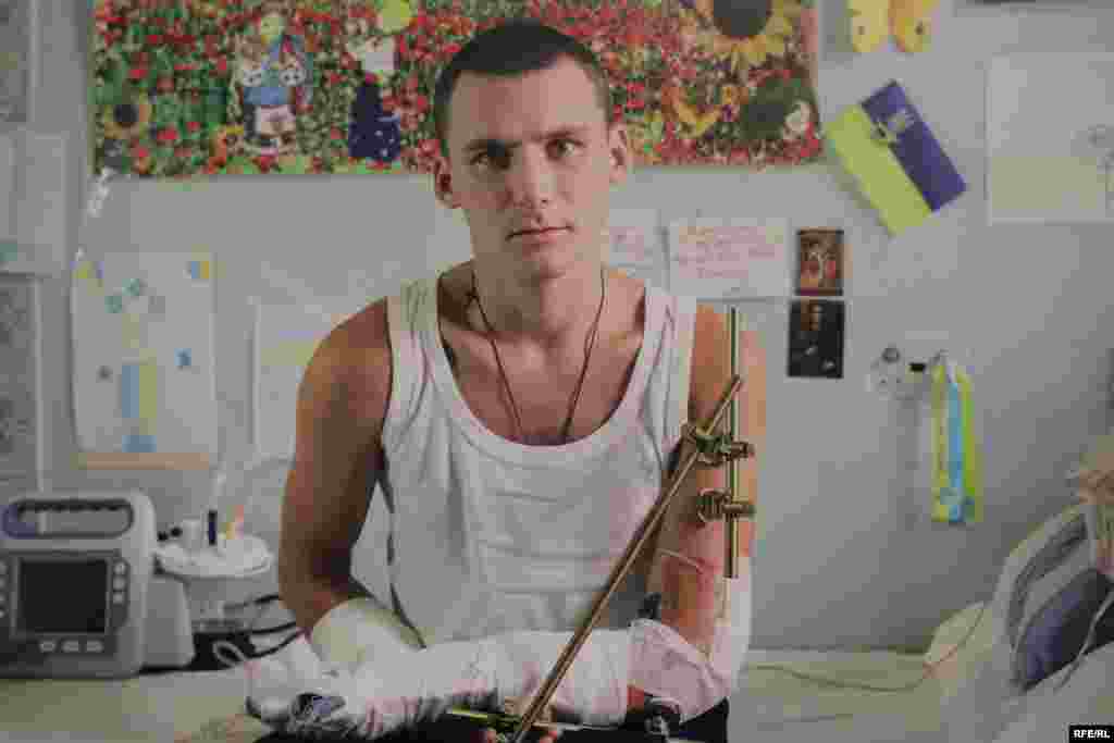 Девятілов Дмитро. Численні вогнепальні поранення. Складний перелом правої руки. Фото Олександра Чекменьова