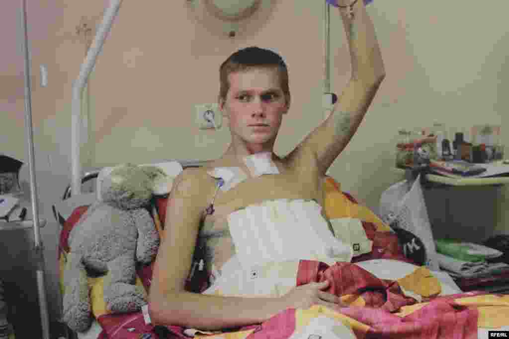 Федоренко Назар. Численні осколкові травми, поранення перикарду легень, кишківника, резекція печінки. Понад місяць перебуває в реанімації. Фото Олександра Чекменьова