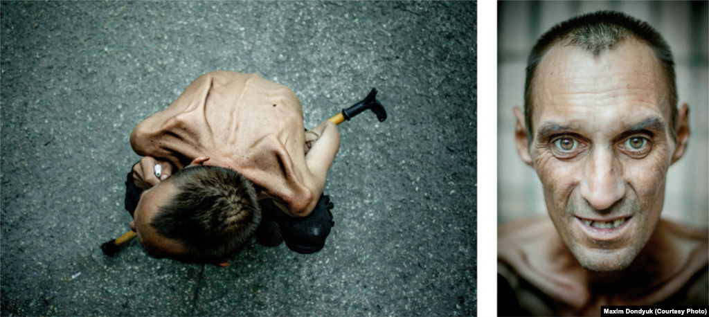 Геннадій, 42 роки. Діагноз: мультирезистентний туберкульоз і ВІЛ. Херсонський протитуберкульозний диспансер, серпень 2011 року. Розповів, що хворіє на туберкульоз шість років. Як захворів, не знає. Працював на риболовецькому судні на Камчатці. Повернувся, отримавши лист від матері, що вона помирає. Знайти роботи не зміг, почав пиячити. У медзакладі я познайомився з його матір’ю. Як виявилося, вона була жива й здорова. Продавала речі з будинку, збирала пляшки, щоб купити ліки та їжу синові. Помер 12 жовтня 2011 року.