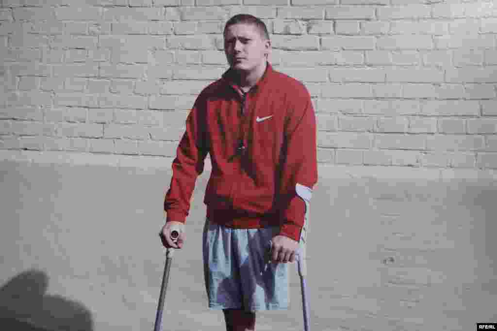 Ільницький Сергій. Поранений під час обстрілів Градамина кордоні з Росією. Висока ампутація лівої ноги. Фото Олександра Чекменьова