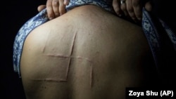 Богдан Сергієць був у полоні всього 10 годин у травні 2014 року. Бойовики вирізали йому на спині свастику, шрам залишився до цих пір Богдан згадує, як його мучителі обговорювали, що його не слід випускати живим, щоб ніхто не побачив, що вони зробили